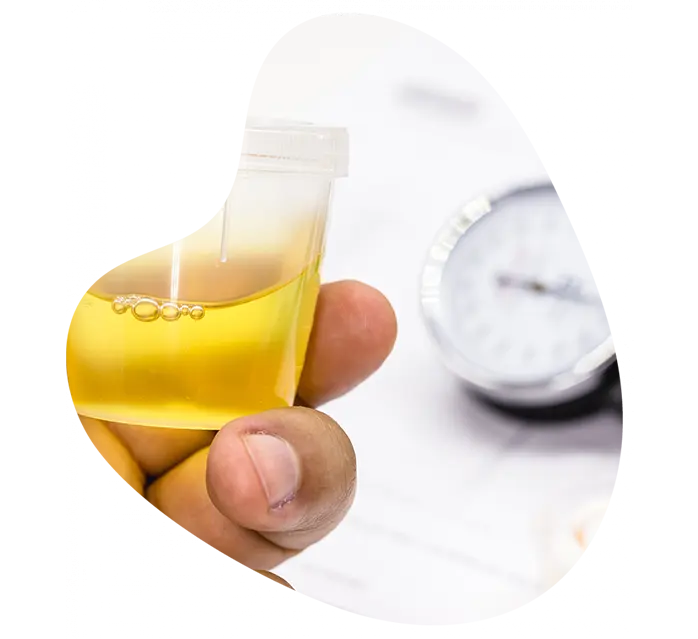 Üroflowmetre (İdrar Akım Analizi)